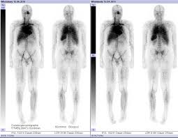 radiologie szintigraphie