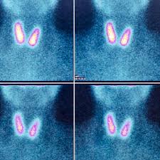 szintigraphie kontrastmittel