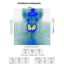 radiologische schilddrüsenuntersuchung