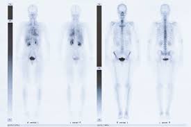 szintigraphie radiologie