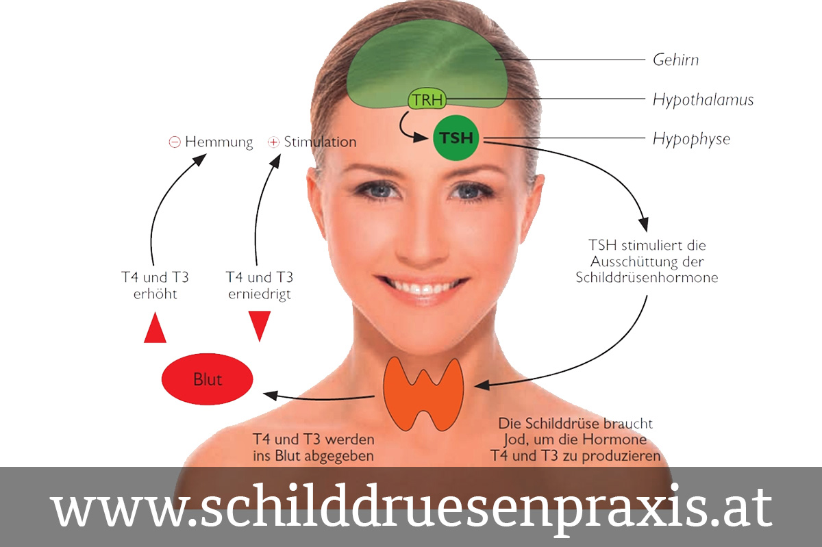 isotopenuntersuchung schilddrüse