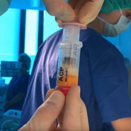 nuklearmedizin kniearthrose