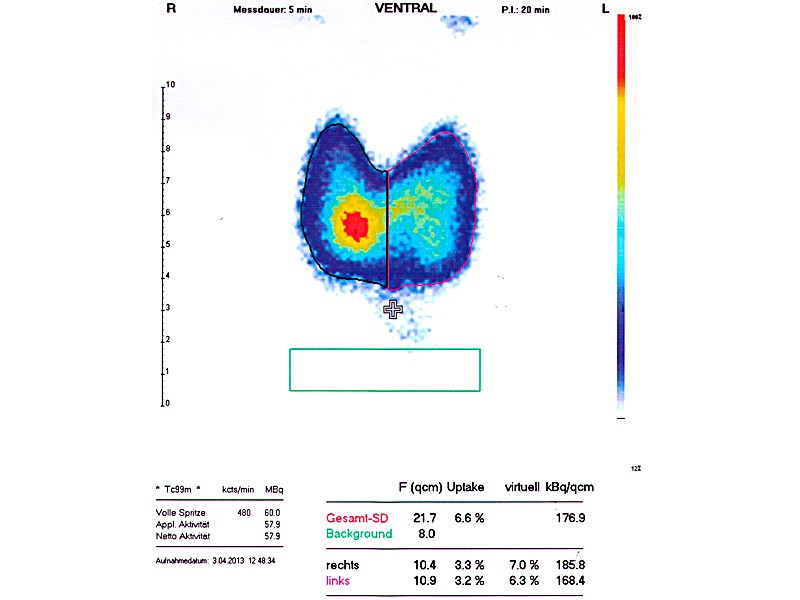 akh schilddrüsenambulanz
